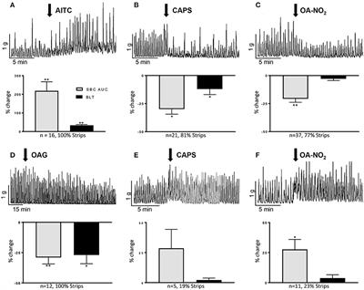 TRP Channel Agonists Activate Different Afferent Neuromodulatory Mechanisms in Guinea Pig Urinary Bladder